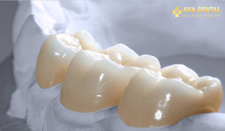 Chất liệu răng sứ sinh học mỏng nhẹ