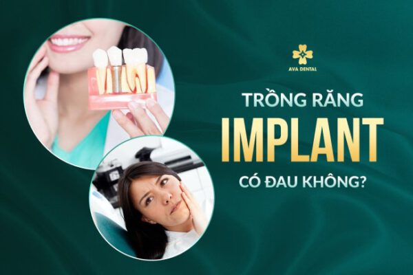 Trong-rang-Implant-co-dau-khong