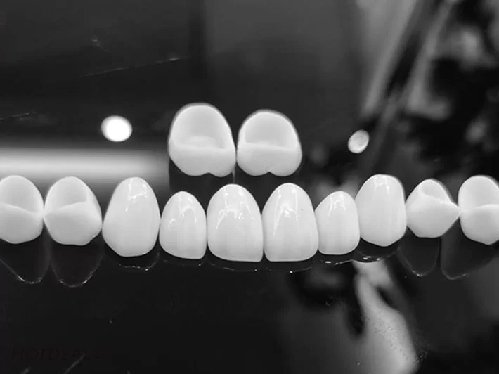So sánh răng sứ Zirconia và Katana